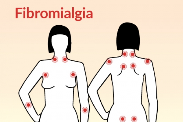 Fibromialgia, una enfermedad en femenino